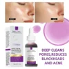 AHA+BHA Salicylic Acid Exfoliating Face Serum Deep Pore Cleansing & Gentle Surface Exfoliation Smooth Skin Brighten Complexion - Image 2