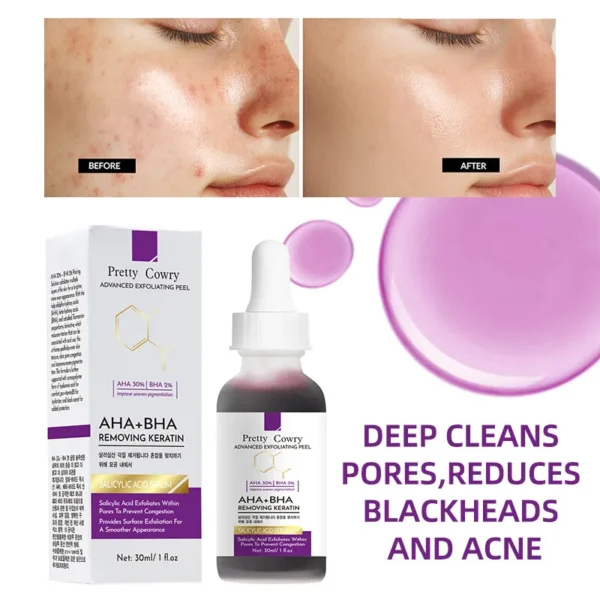 AHA+BHA Salicylic Acid Exfoliating Face Serum Deep Pore Cleansing & Gentle Surface Exfoliation Smooth Skin Brighten Complexion - Image 2