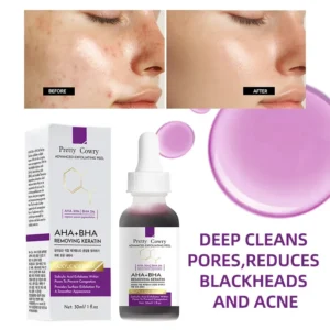 AHA 30% + BHA 2% Exfoliating Face Peel Serum – Gentle Chemical Exfoliator for Dark Spots, Pore Minimizing & Skin Renewal